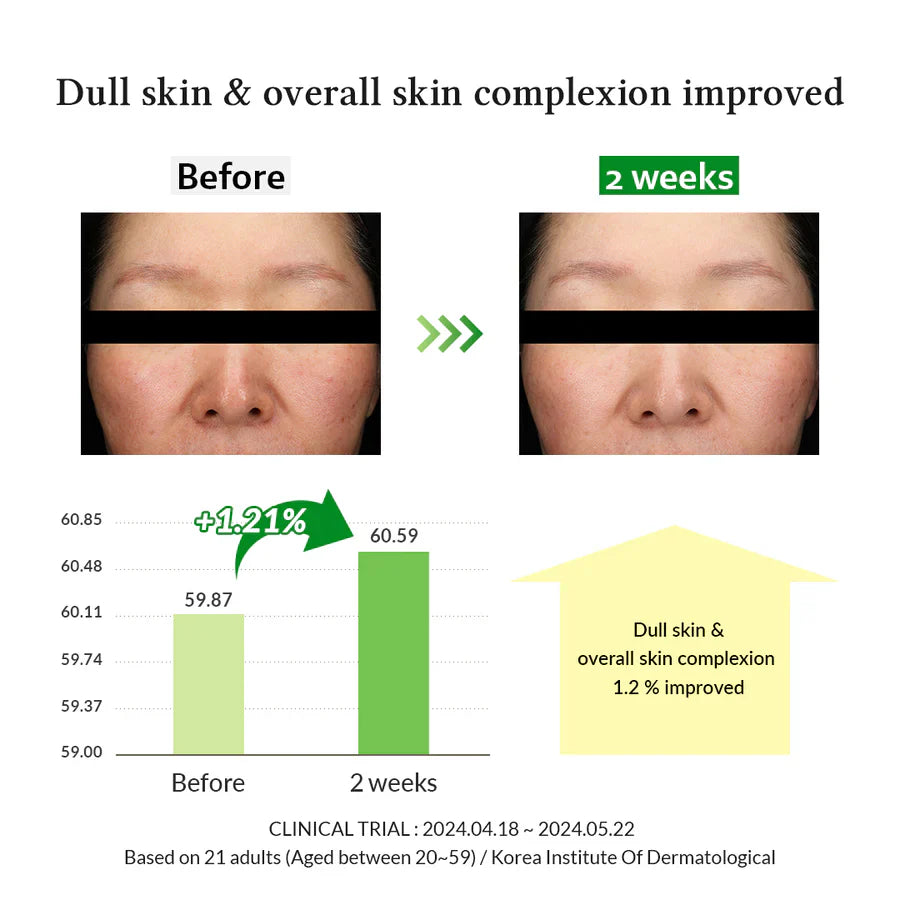 est vitamin C serum for sun-exposed, dull skin – Dr. Althea available now in Kuwait