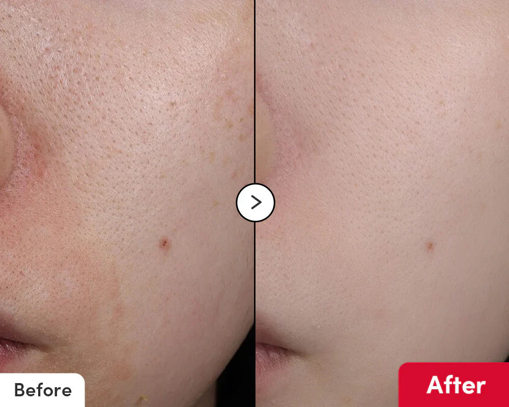 Buy EQQUALBERRY vitamin serum in Kuwait for glowing skin