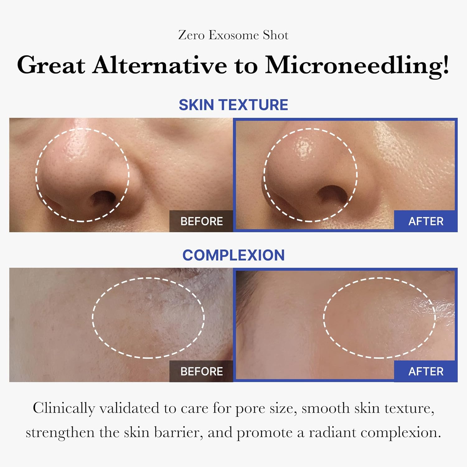 Korean pore care ampoule Medicube Skin Valet Kuwait