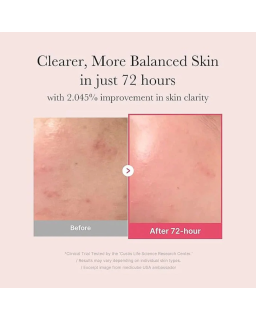 Medicube serum for dark spots and glow Kuwait