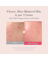 Medicube serum for dark spots and glow Kuwait